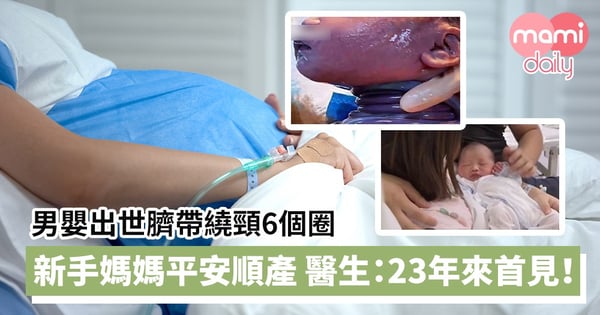 【奇蹟BB】男嬰出世臍帶繞頸6個圈　新手媽媽平安順產　醫生：23年來首見！