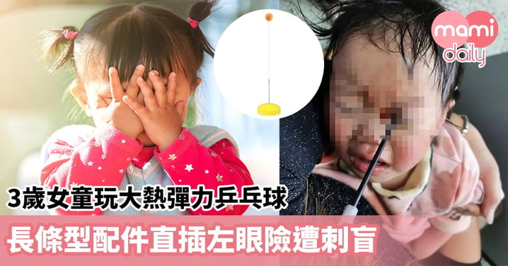 【危險玩具】3歲女童玩大熱彈力乒乓球　 長條型配件直插左眼險遭刺盲