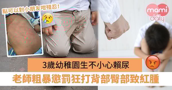 【老師虐兒】3歲幼稚園生不小心賴尿　老師粗暴懲罰狂打背部臀部致紅腫