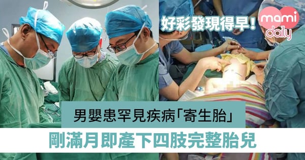 【罕見疾病】男嬰患罕見疾病「寄生胎」 剛滿月即產下四肢完整胎兒
