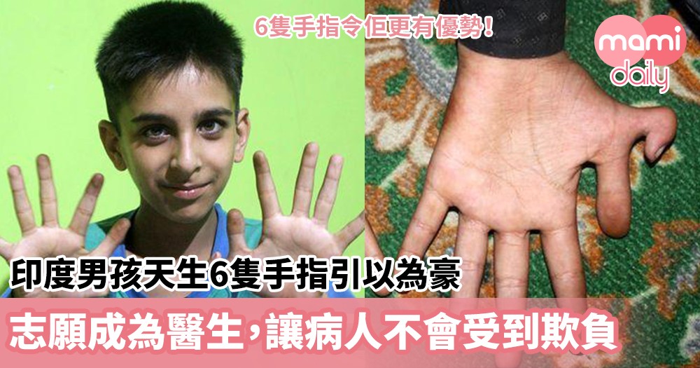 【罕見疾病】印度男孩天生6隻手指引以為豪　孩子王：志願成為醫生，讓病人不會受到欺負