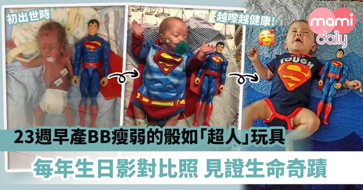 【奇蹟BB】23週早產BB瘦弱的骰如「超人」玩具　每年生日影對比照見證生命奇蹟