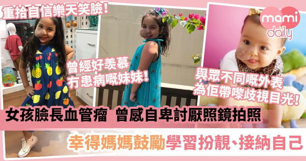 【活出真我】女孩患血管瘤嚴重影響外觀 曾感自卑討厭照鏡拍照 幸得媽媽鼓勵學習扮靚、接納自己