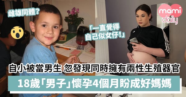 【雌雄同體】自小被當作男生去年竟發現同時擁有兩性生殖器官　18歲「男子」懷孕4個月盼成為好媽媽