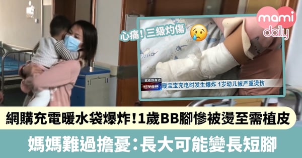 【家居安全】網購充電暖水袋爆炸！1歲BB腳慘被燙至需植皮　媽媽難過擔憂：長大可能變長短腳