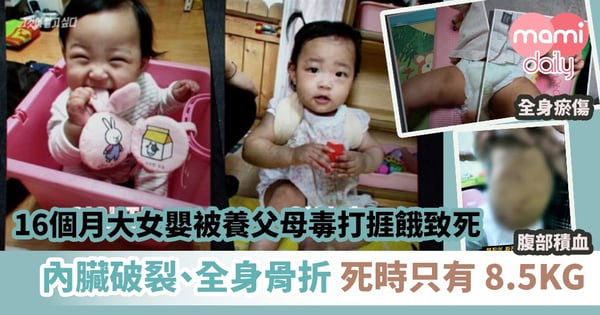 【恐怖虐兒】16個月大女嬰被養父母毒打捱餓致死 內臟破裂、全身骨折 死時只有 8.5KG