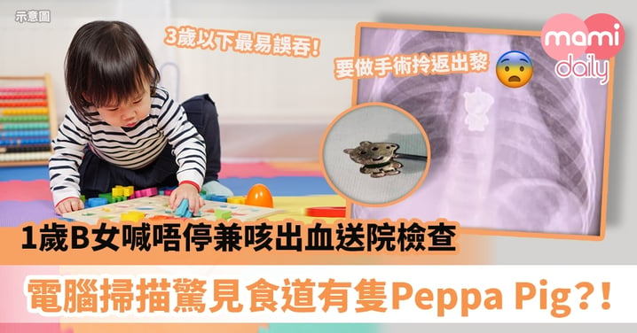 【誤吞異物】1歲B女喊唔停兼咳出血即送院檢查　電腦掃描驚見食道有隻「Peppa Pig」？！