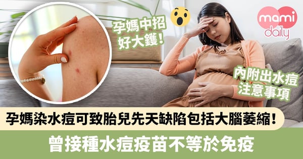 【懷孕注意】孕媽染水痘可致胎兒先天性缺陷包括大腦萎縮!曾接種水痘疫苗不等於免疫