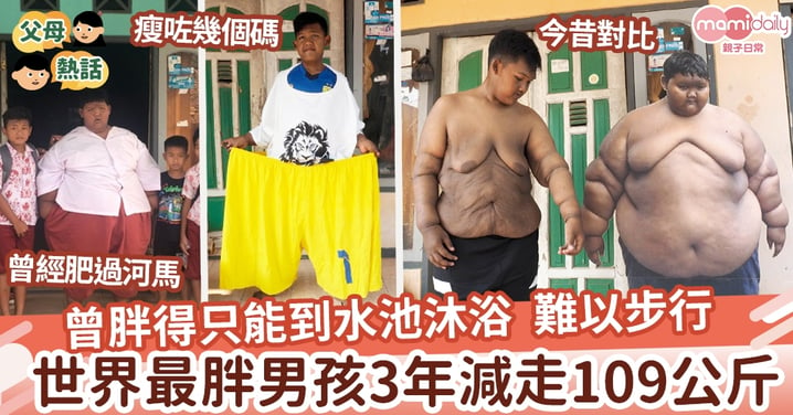 【勵志減肥】曾胖得只能到水池沐浴 難以步行 「世界最胖男孩」三年減走109公斤