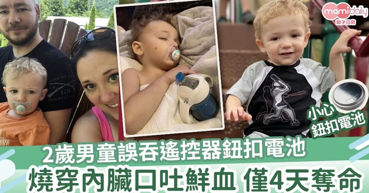 【意外】2歲男童誤吞遙控器鈕扣電池  燒穿內臟僅4天奪命