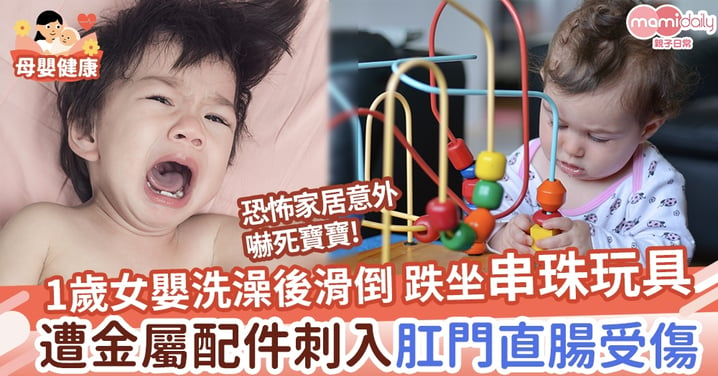 【家居意外】1歲女嬰洗澡後滑倒 跌坐串珠玩具 遭金屬配件刺入肛門、直腸