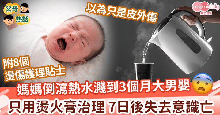 【嬰兒意外】媽媽倒瀉熱水濺到3個月大男嬰 只用燙火膏治理 7日後失去意識亡