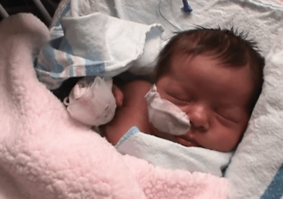 發現女兒的生長線和各種能力都不達標，直至Ever兩歲正式確診天使綜合症