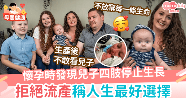 【罕見病】懷孕時發現兒子四肢停止生長 拒絕流產稱人生最好選擇 兒子出生時沒有雙腿只有一臂