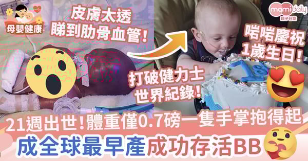 【奇蹟寶寶】21週出世!體重僅0.7磅一隻手掌抱得起 破世界紀錄成全球最早產成功存活BB
