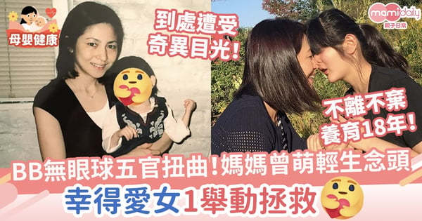 【罕見病】BB天生無眼球兼五官扭曲！媽媽照顧壓力大曾萌輕生念頭　幸得愛女1舉動拯救