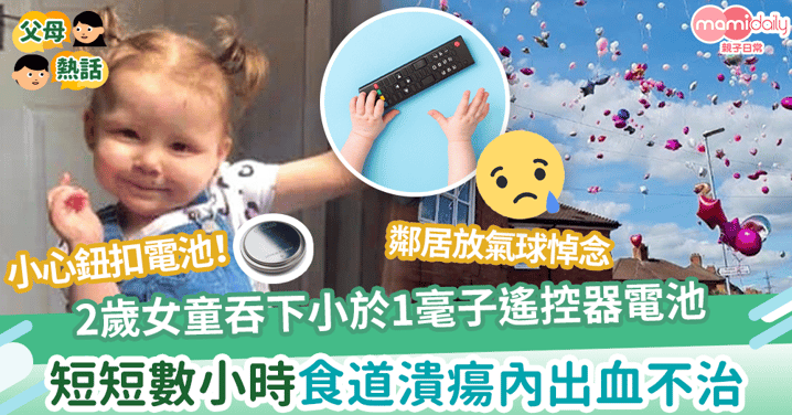 【兒童意外】2歲女童意外吞下小於「1毫子」遙控器電池 短短數小時食道潰瘍內出血不治