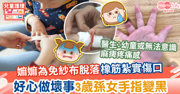 【護理常識】嫲嫲用橡筋紗布捆手指包紮傷口 令3歲孫女手指變黑好心做壞事