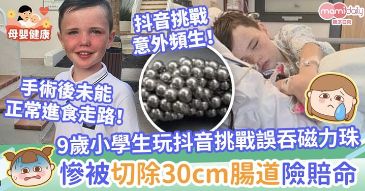 【抖音意外】9歲小學生玩抖音挑戰誤吞磁力珠　慘被切除30cm腸道險賠上性命