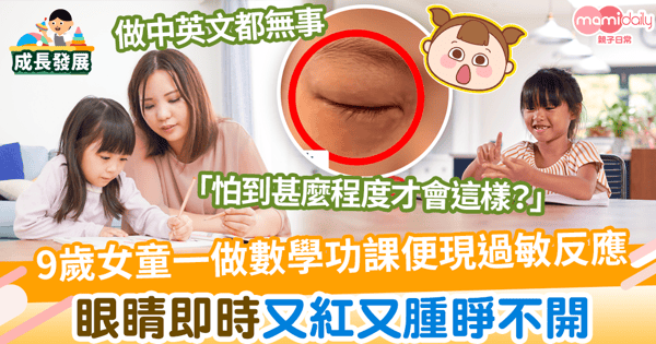 【數學恐懼症】9歲女童一做數學功課便現過敏反應 眼睛即時又紅又腫睜不開