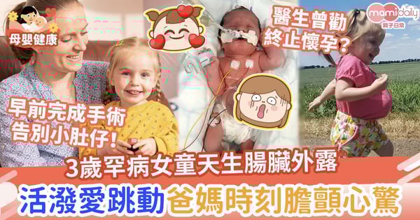 【先天性臍膨出】3歲罕病女童天生腸臟外露 活潑愛跳動爸媽時刻膽顫心驚