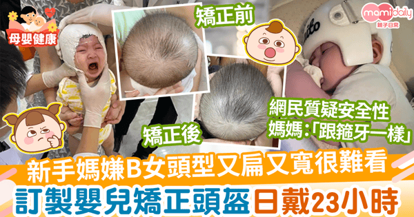 【寶寶頭型】新手媽嫌B女頭型又扁又寬很難看 不顧反對訂製矯正頭盔日戴23小時