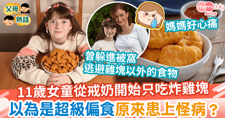 【飲食習慣】11歲女童從戒奶開始只吃炸雞塊　以為是超級偏食原來患上怪病
