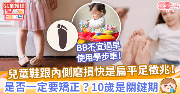 【扁平足原因】過早使用學步車可致足弓塌陷？　一文睇扁平足種類、原因、徵狀等！
