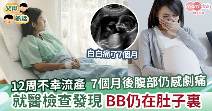 【離譜】流產7個月後腹部傳來劇痛  就醫檢查發現BB仍在肚子裏