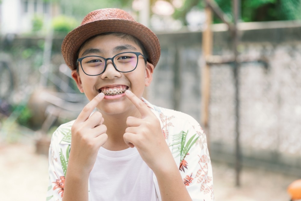 箍牙後更要注重口腔健康。