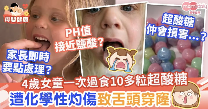 【超酸糖】4歲女童食超酸糖致化學性灼傷　牙醫：PH值接近鹽酸