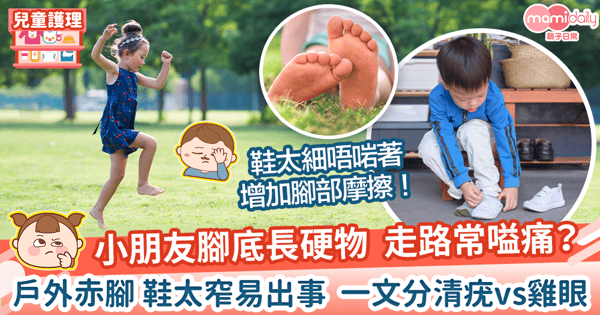【疣vs雞眼】小朋友腳底長硬物究竟是疣或雞眼？　做好幾件事保護足底健康！