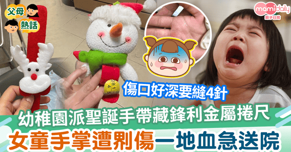 【玩具安全】幼稚園派發聖誕手帶藏鋒利金屬捲尺　女童手掌遭?傷一地血縫4針