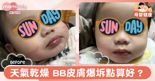 【育嬰貼士】天氣乾燥  BB皮膚爆坼點算好｜Baby’s Wardrobe