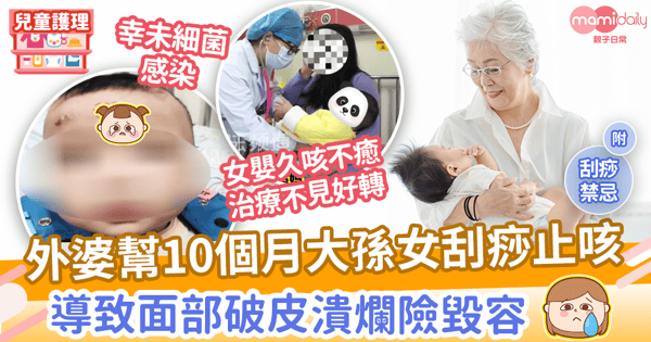 【刮痧禁忌】外婆幫10個月大孫女刮痧止咳 致其面部潰爛兼出皮疹