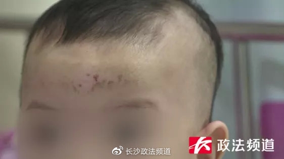 女嬰目前情況穩定。