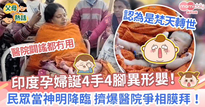 【先天缺陷】印度孕婦誕4手4腳異形嬰！　居民當神明降臨擠爆醫院爭相膜拜！