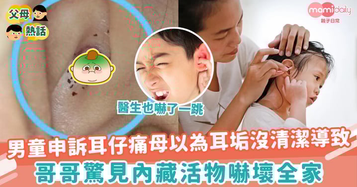 【耳朵護理】男童申訴耳仔痛母以為耳垢沒清潔導致 哥哥驚見內藏活物嚇壞全家