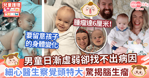 【兒童健康】BB久病不癒頭顱大一圈無人發現 火眼金睛醫生秒察覺驚揭BB腦生瘤