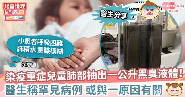 【兒童確診】馬國染疫重症兒童肺部抽出一公升黑臭液體　醫生稱罕見病例或與一原因有關