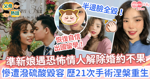 【恐怖情人】越南準新娘遇恐怖情人解除婚約不果　慘遭潑硫酸毀容 歷21次手術涅槃重生