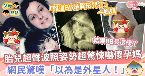 【超聲波檢查】胎兒超聲波照姿勢超驚悚孕媽嚇傻　網民驚嘆「以為是外星人！」