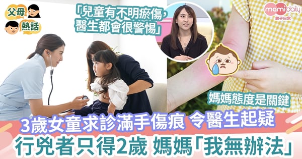 【二胎的煩惱】3歲女童滿手傷痕醫生起疑 行兇者只得2歲媽媽「我無辦法」