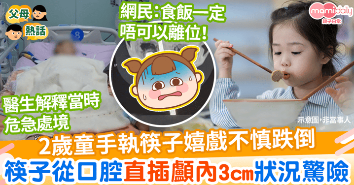 【不幸意外】2歲童手執筷子奔跑嬉戲不慎跌倒　筷子從口腔直插顱內3cm險傷動脈