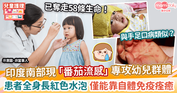 【兒童健康】「番茄流感」肆虐印度南部專攻幼兒群體　患者長紅色水泡至少奪58命!
