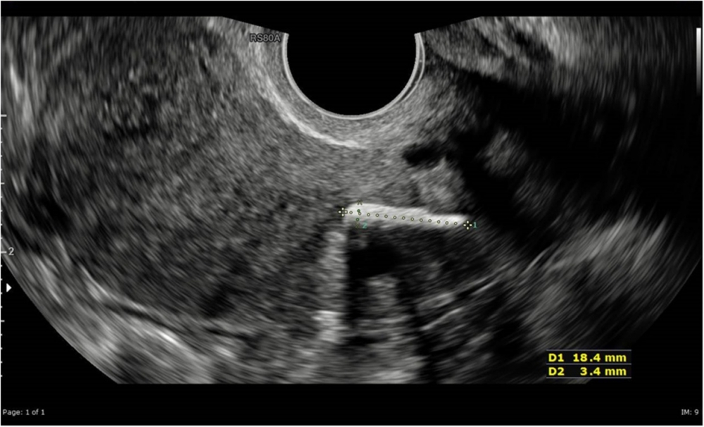 NINTCHDBPICT000744865628