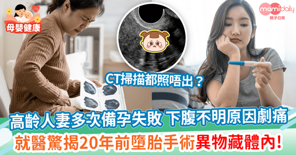 【手術失誤】高齡人妻多次備孕失敗 下腹不明原因劇痛　就醫驚揭20年前墮胎手術異物藏體內