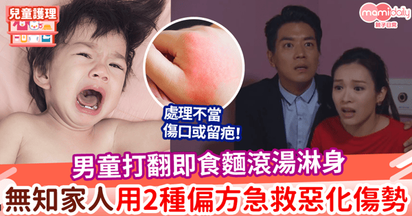 【家居意外】男童打翻即食麵滾湯淋身 無知家人用2種偏方急救惡化傷勢
