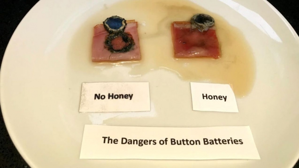 媽媽表示蜜糖能有效包覆鈕扣電池，讓其滑到胃部，減少對食道的傷害。