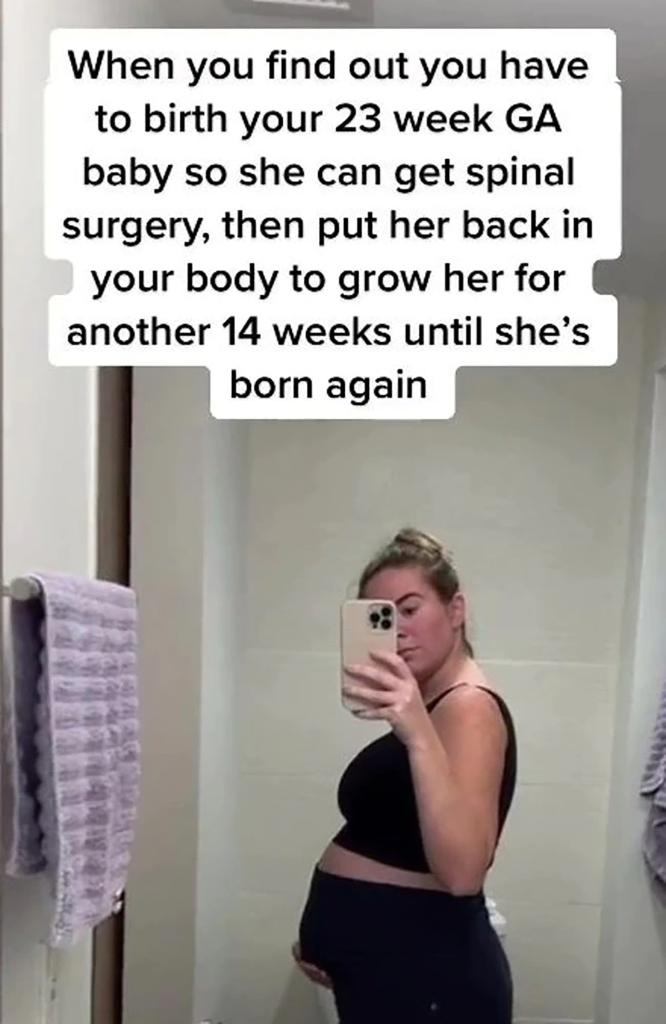 Jacqueline在專家的建議下,於懷孕23週時進行罕見手術